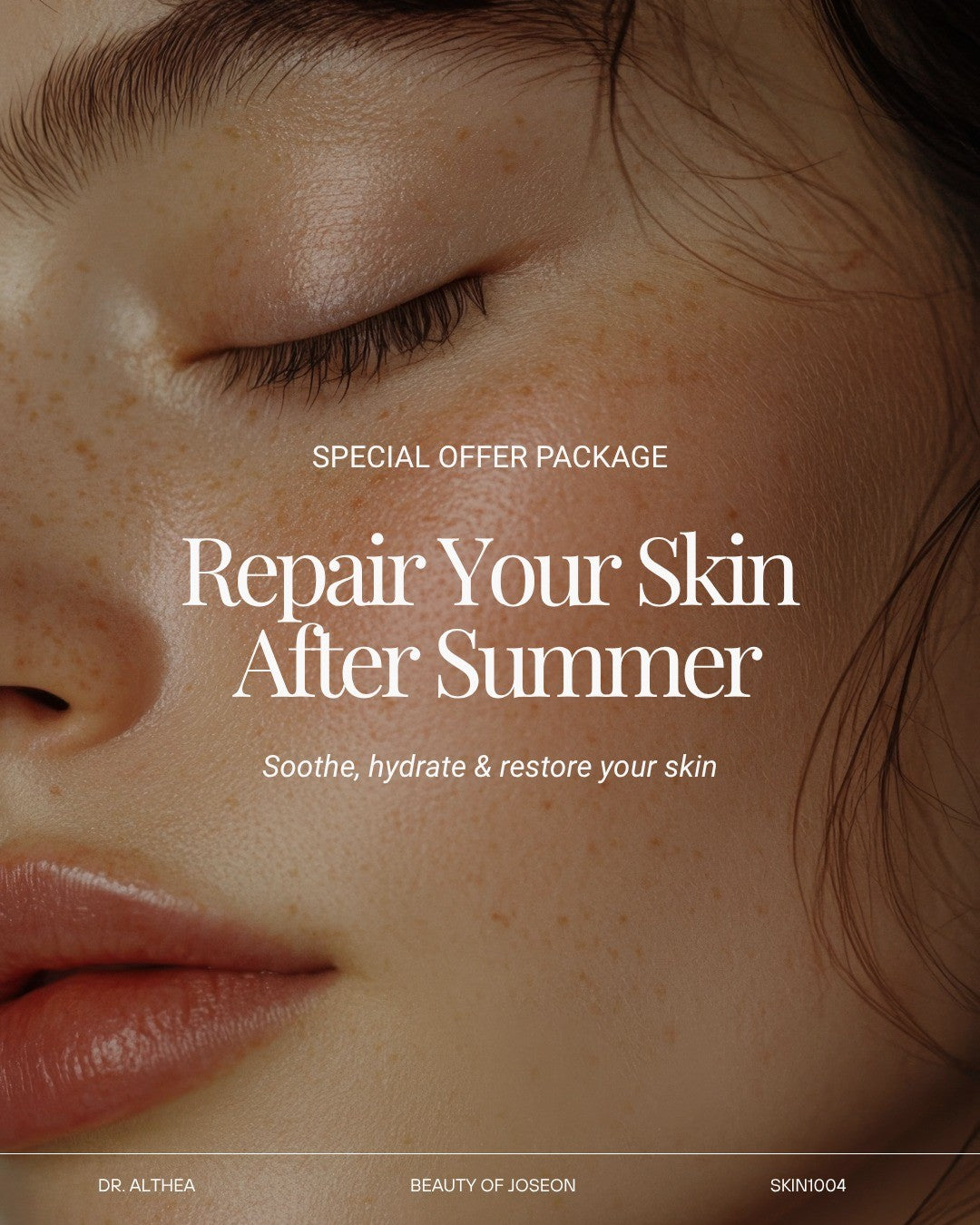 Special Offer - Skin Barrier Recovery Set (Skin1004, Beauty of Joseon, Dr. Althea)